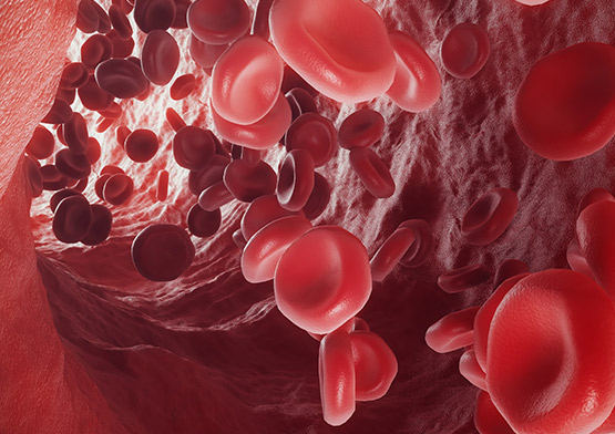 Gum Disease Stages Springfield, MO